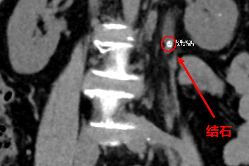 急诊ct.png 急诊ct.png