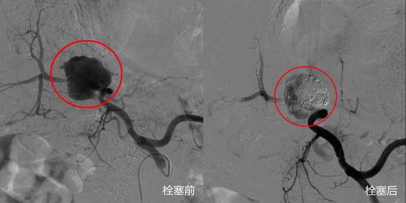 前后对比.jpg 前后对比.jpg