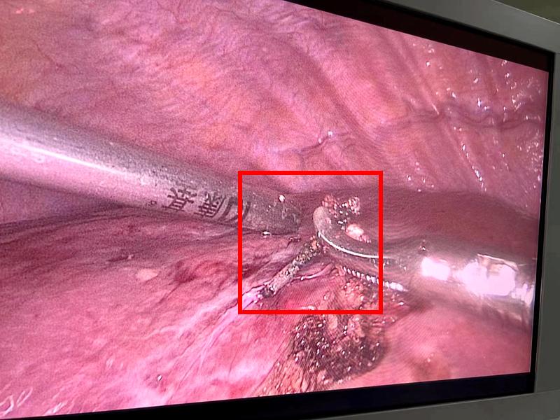 d6d5bce80dd535236bdca9f31186d3c.jpg d6d5bce80dd535236bdca9f31186d3c.jpg