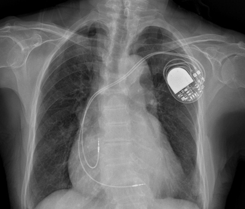 bc275e620e7cac35e034704daa99e63.jpg bc275e620e7cac35e034704daa99e63.jpg