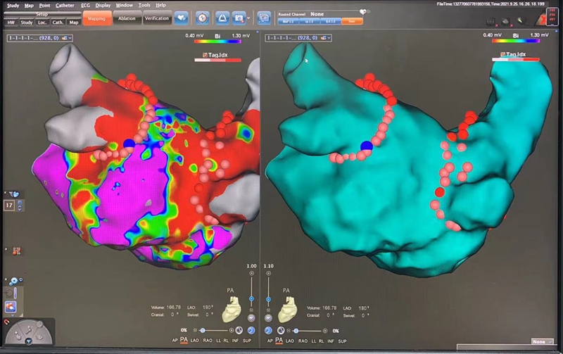 ef4849b98be01d1089c48733d1f1682.jpg ef4849b98be01d1089c48733d1f1682.jpg