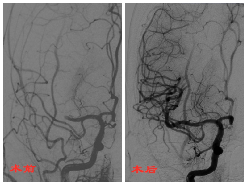 脑外 拼图.jpg 脑外 拼图.jpg
