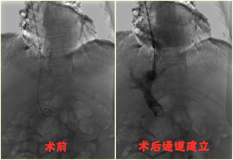 术前1_副本.jpg 术前1_副本.jpg