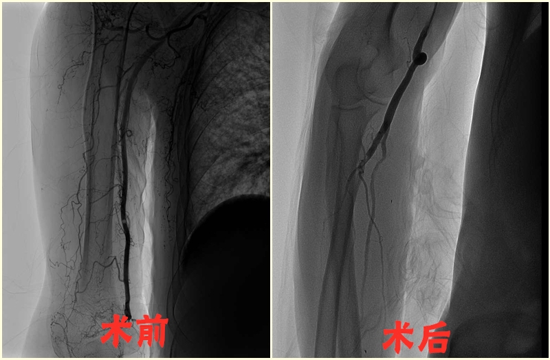 术后_副本.jpg 术后_副本.jpg