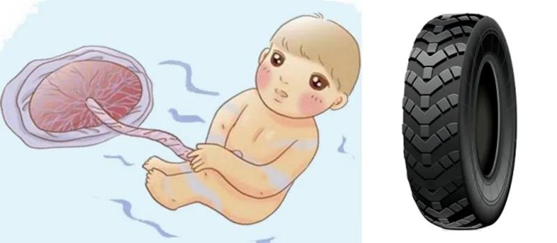 C:\Users\admin\Desktop\20230203帆状胎盘血管前置\640 (4).jpg