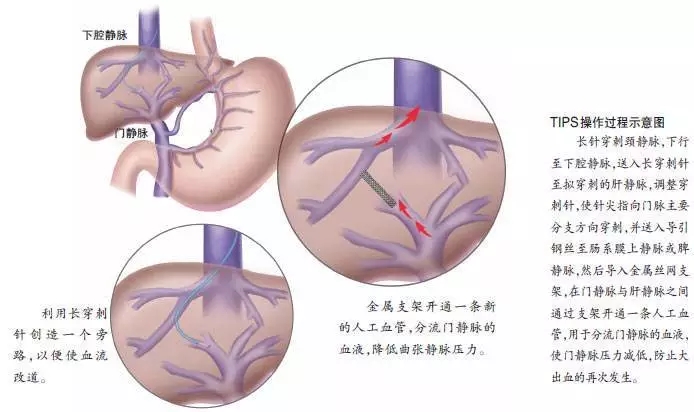 9059625-1c00fdba141d6c85.webp.jpg 9059625-1c00fdba141d6c85.webp.jpg