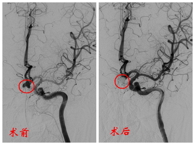 对比图.jpg 对比图.jpg