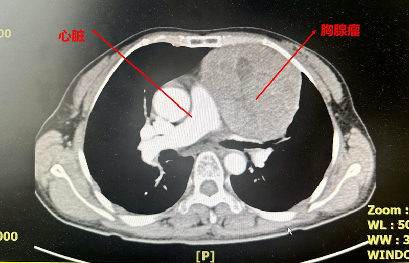 32f745d11e4501aa6757cba482d0c1d.jpg 32f745d11e4501aa6757cba482d0c1d.jpg